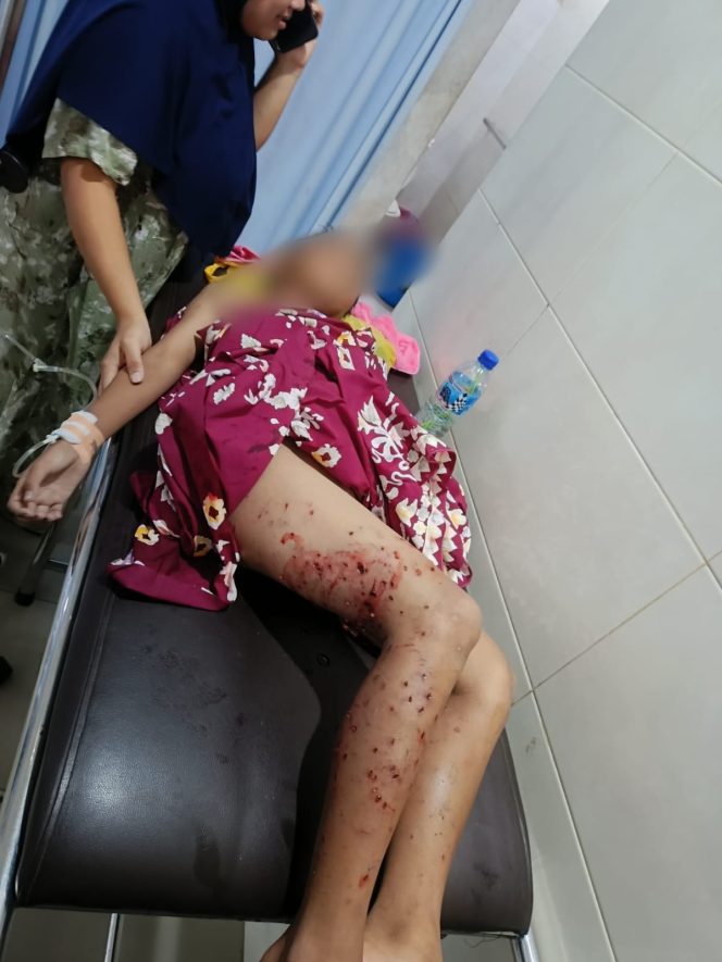 
 Foto : Seorang bocah berusia 9 tahun alamat desa terara di serang ajjinh liar pada hari senin (22/09).