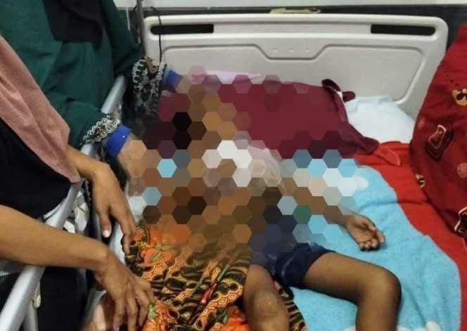 
 Foto : Seorang siswa sekolah dasar (SD) kelas 1 di salah satu sekolah di Kecamatan Pringgabaya, Lombok Timur (Lotim), berinisial MHASF, diduga menjadi korban perundungan oleh teman sekolahnya. Saat ini siswa sedang dalam perawatan di RSUD Soedjono Selong 